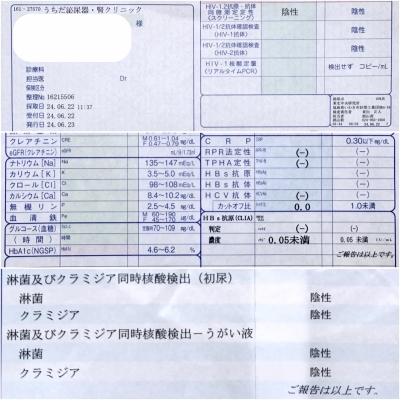 SAKU(ｻｸ) 性病検査結果